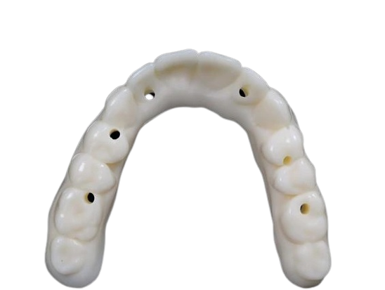 KeyDenture Try-In