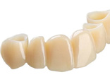 The TrueDent Difference: A new resin for 3D printing of permanent dentures and temporary crowns and bridges.